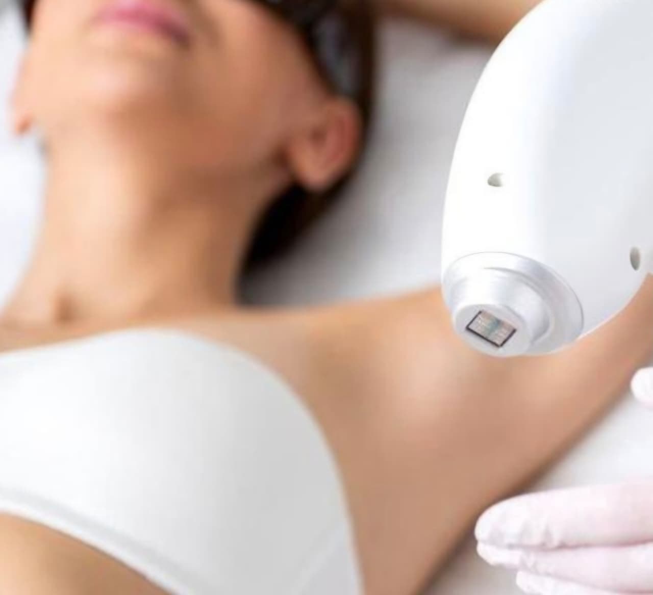 Procedimento de depilação a laser